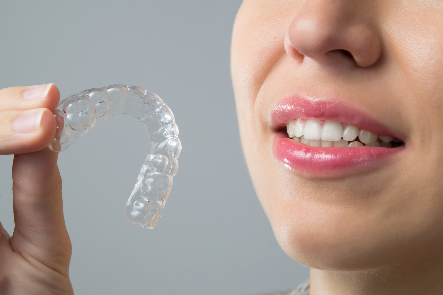 6 things you should know before getting Clear Aligners
