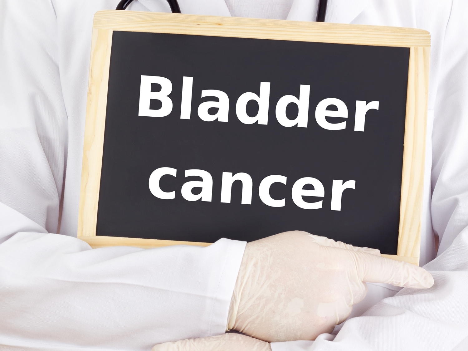 Bladder Cancer and the Different Types