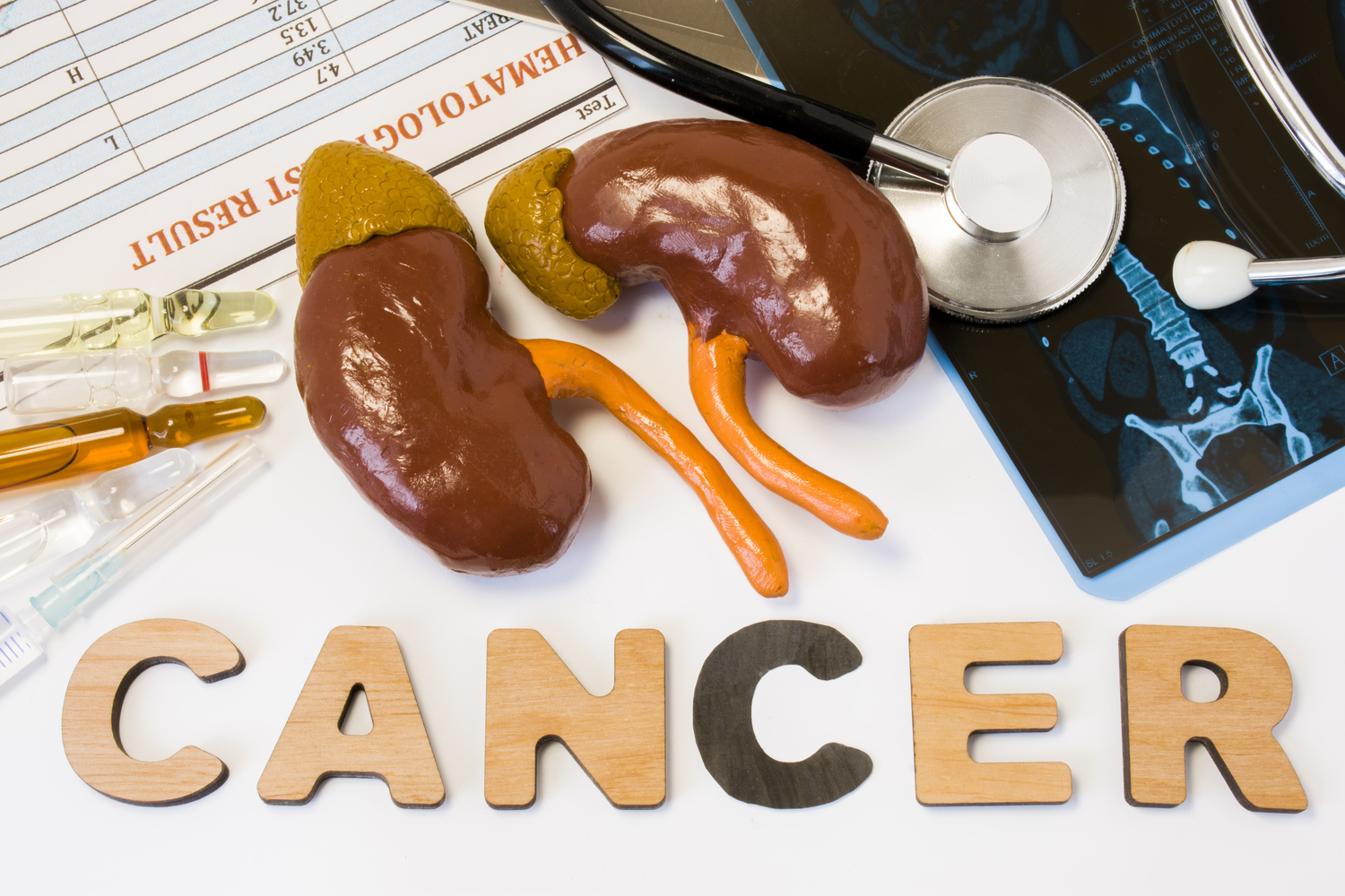 Common Kidney Cancer Treatments