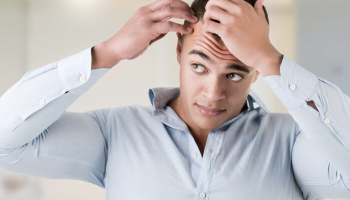 Common causes of balding