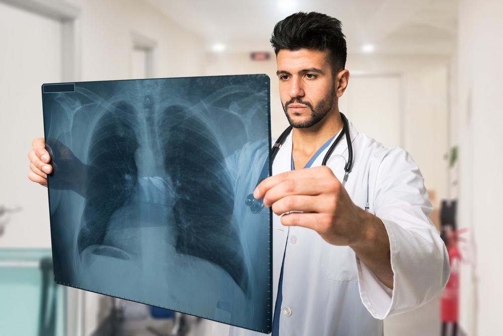 Lung Cancer Common Treatments