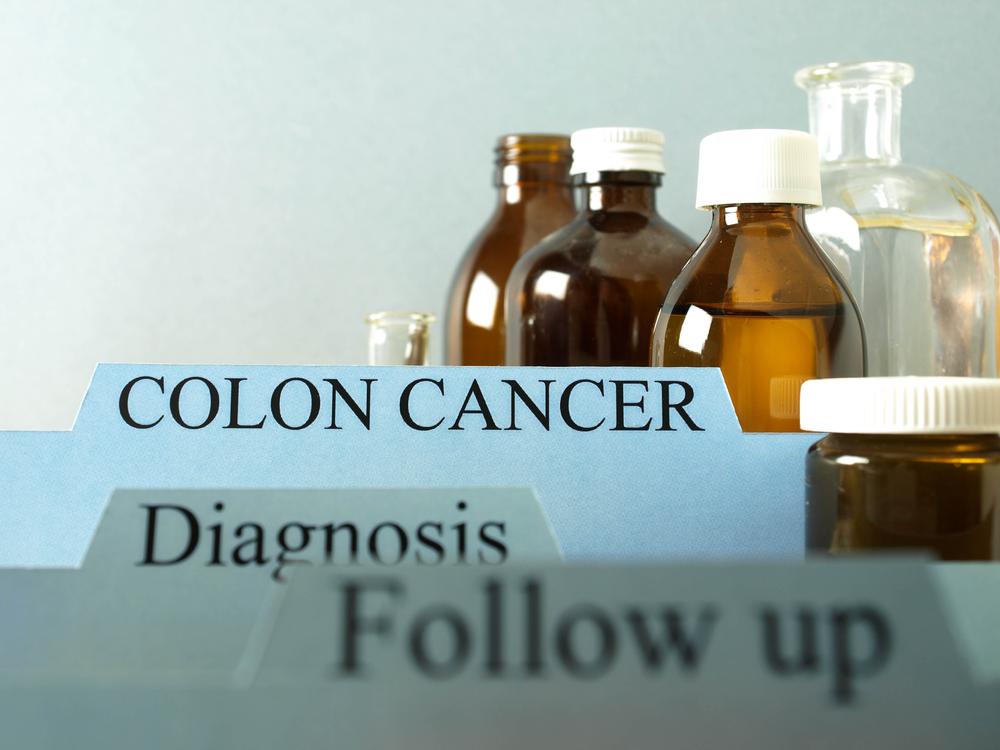 Signs and Symptoms of Colon Cancer