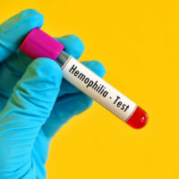 Tips to care for a child with hemophilia