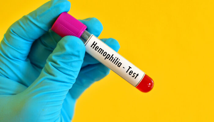 Tips to care for a child with hemophilia
