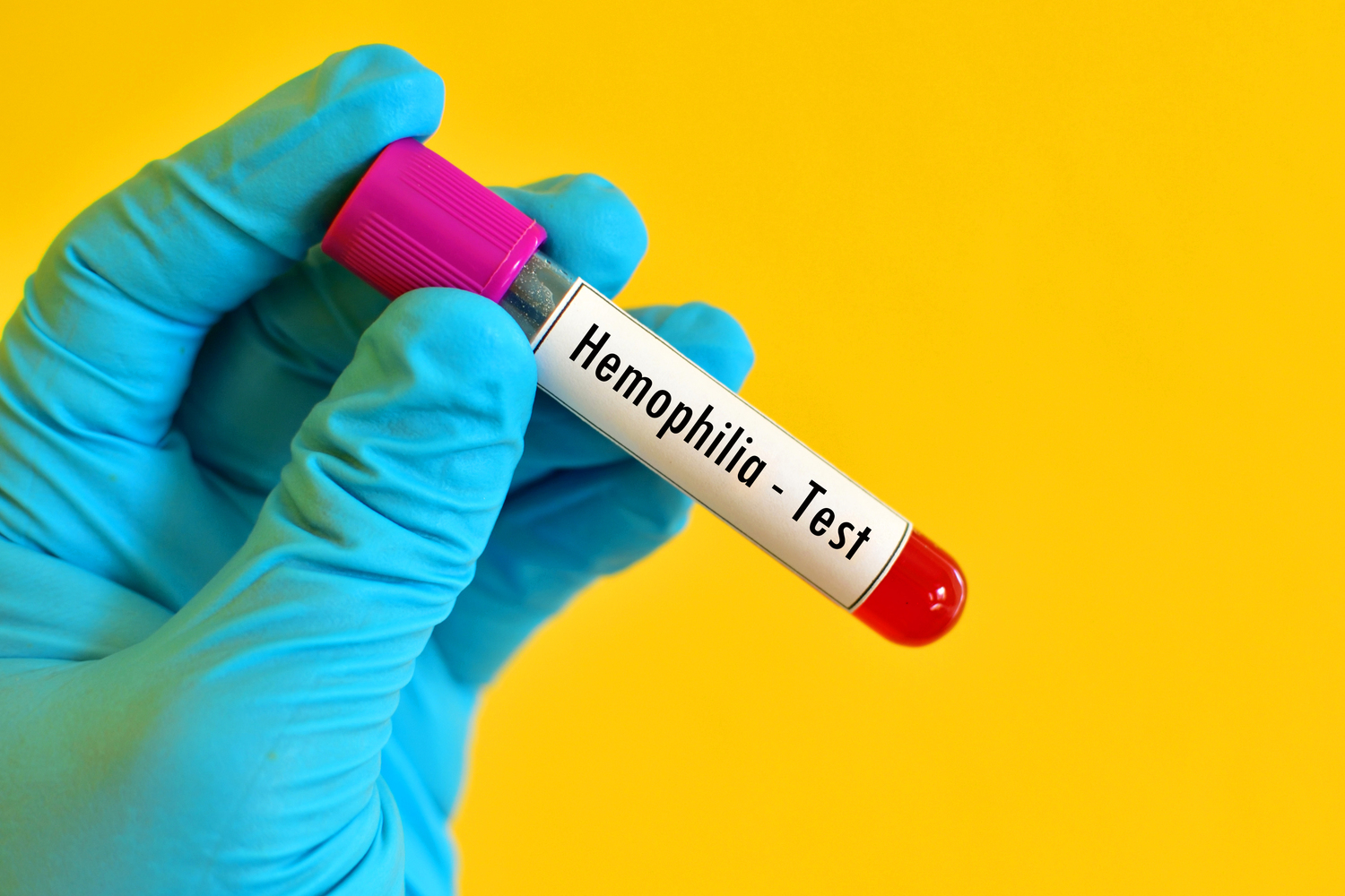 Tips to care for a child with hemophilia