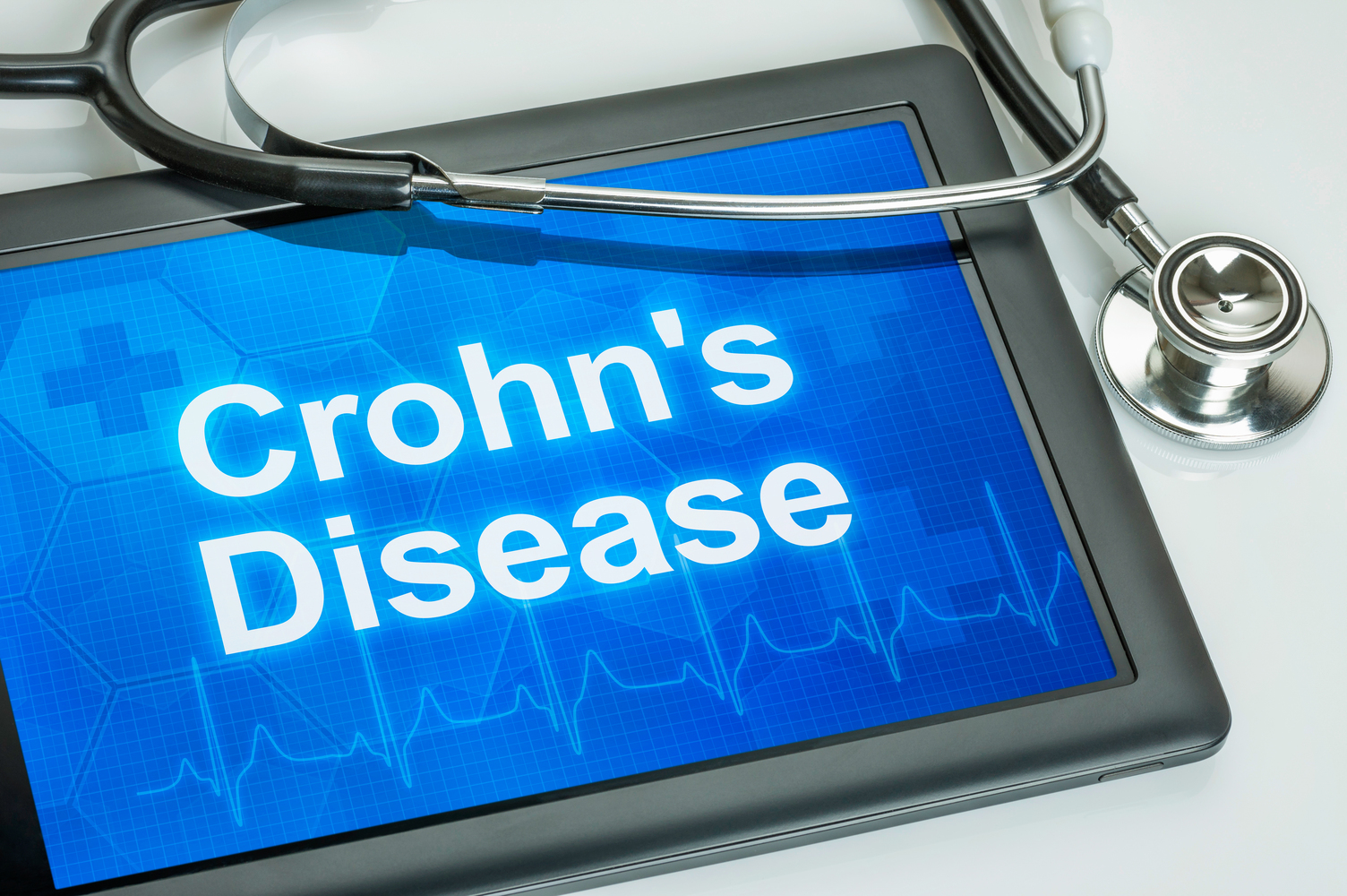 Diagnostic tests for Crohn’s disease