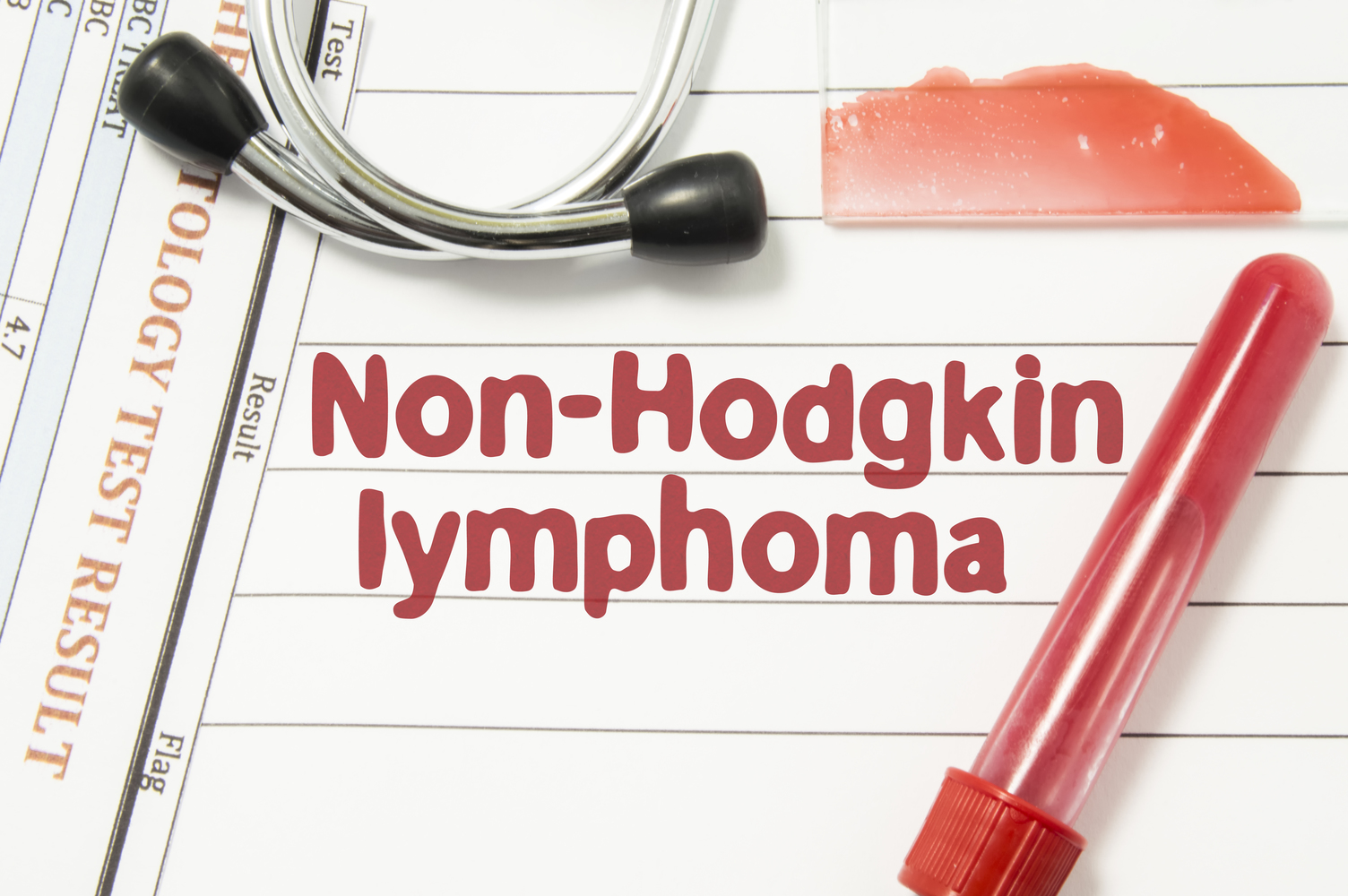What is Non-Hodgkin’s Lymphoma