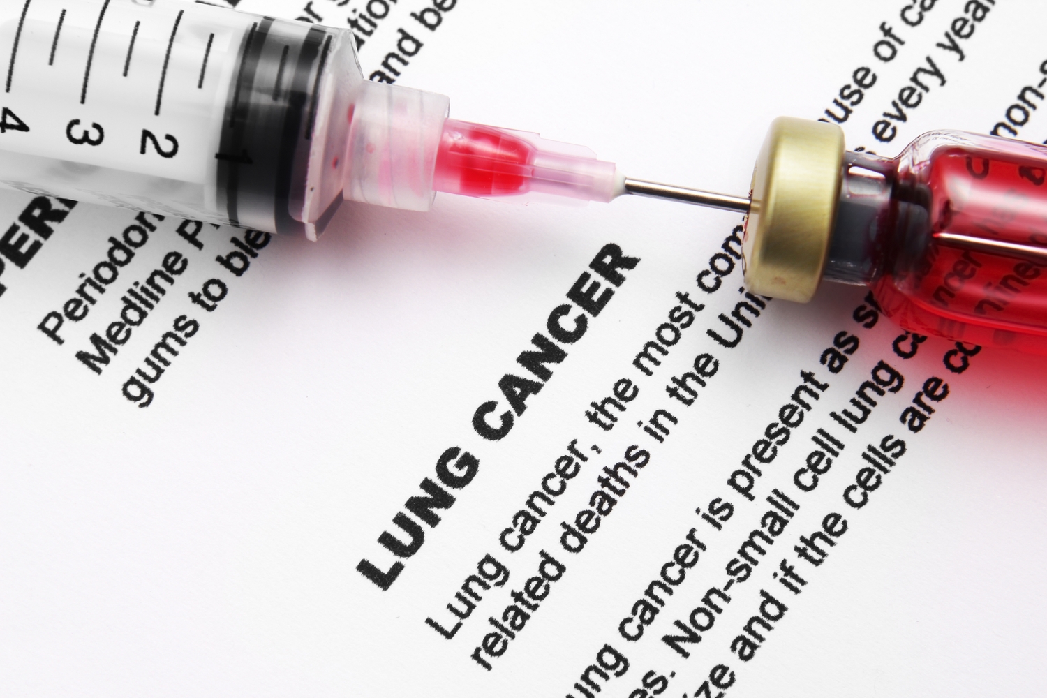 U.S. Cities With the Highest Rates of Lung Cancer